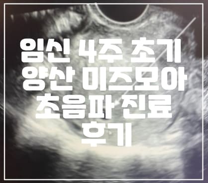 임신 4주 초기 양산 미즈모아 초음파 진료 후기, 임신 초기 주의사항 (+임신 4주 초음파, 임신 진료비 지급 신청서)