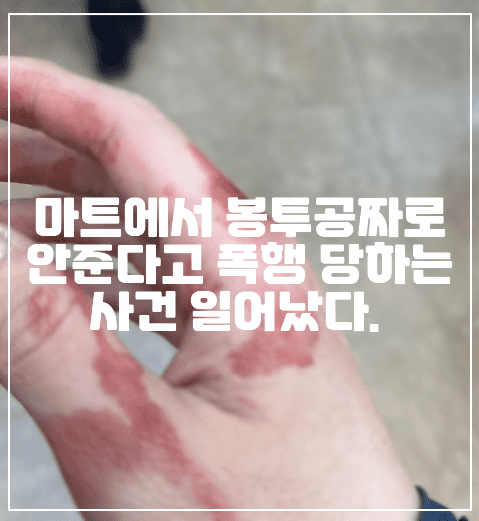 마트에서 봉투공짜로 안준다고 폭행 당하는 사건 일어났다. (+보배드림 링크, 피해 사진, 이빨 사진, 사건 총정리, 보배드림 봉투공짜로 안준다고 폭행당했습니다,)