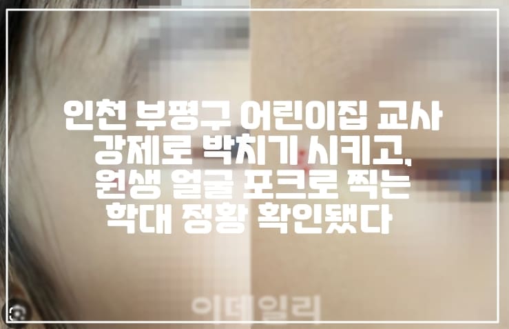 인천 부평구 어린이집 교사 강제로 박치기 시키고, 원생 얼굴 포크로 찍는 학대 정황 확인 CCTV 삭제했다. (+피해 사진, 3살 원아 강제 박치기, 인천 부평구 어린이집 학대, 어린이집 포크 학대, 어린이집 박치기 학대, 어린이집 CCTV 삭제, 3살 아이들 강제 박치기, 인천 어린이집 학대, 인천 부평구 어린이집 학대 정황)