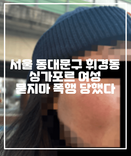 [휘경동 묻지마 폭행사건] 서울 동대문구 휘경동 싱가포르 외국인 유학생 여성 묻지마 폭행 당했다 (+피해사진, 피해자 글 원본사진, 휘경동 외국인 유학생 폭행사건, 휘경동 묻지마 폭행, 휘경동 싱가포르 여성 폭행, 동대문 묻지마 폭행, 동대문 외국인 유학생 폭행, 동대문 싱가포르 여성 폭행, 서울 휘경동에서 산책가능 길에 모르는 사람한테 묻지마 폭행을 당했습니다)