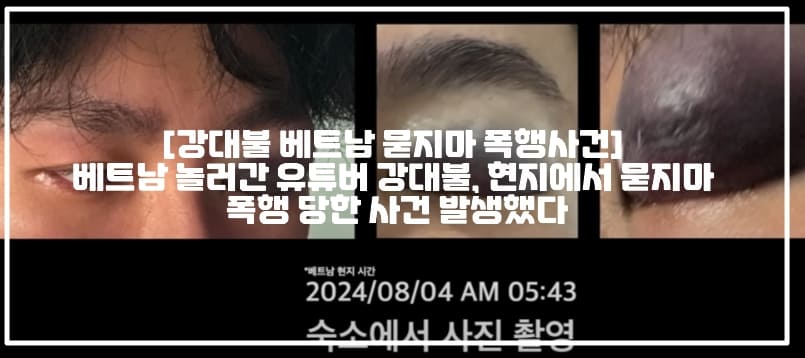 [강대불 베트남 묻지마 폭행사건] 베트남 놀러간 유튜버 강대불, 현지에서 묻지마 폭행 당한 사건 발생했다 (+피해사진, 강대불 베트남에서 죽다 살아났습니다, 강태원 베트남 무차별 폭행,  강대불 베트남 묻지마 폭행, 베트남 여행 무차별 폭행, 호찌민 묻지마 폭행, 호찌민 무차별 폭행, 베트남 유튜버 묻지마 폭행, 호찌민 유튜버 묻지마 폭행, 사건반장 유튜버 베트남 폭행사건, 베트남 의문의 폭행)